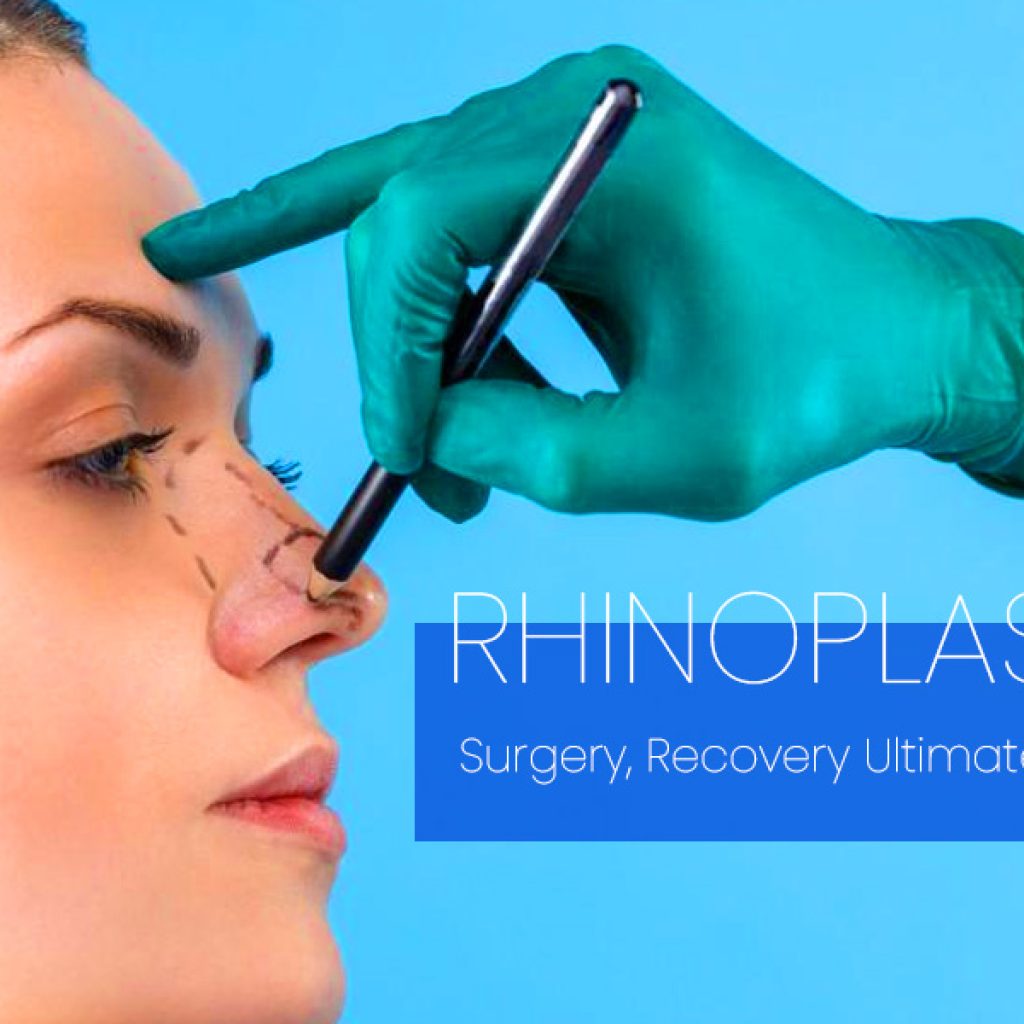 Rhinoplasty (Nose Job): Surgery, Recovery Ultimate Guide