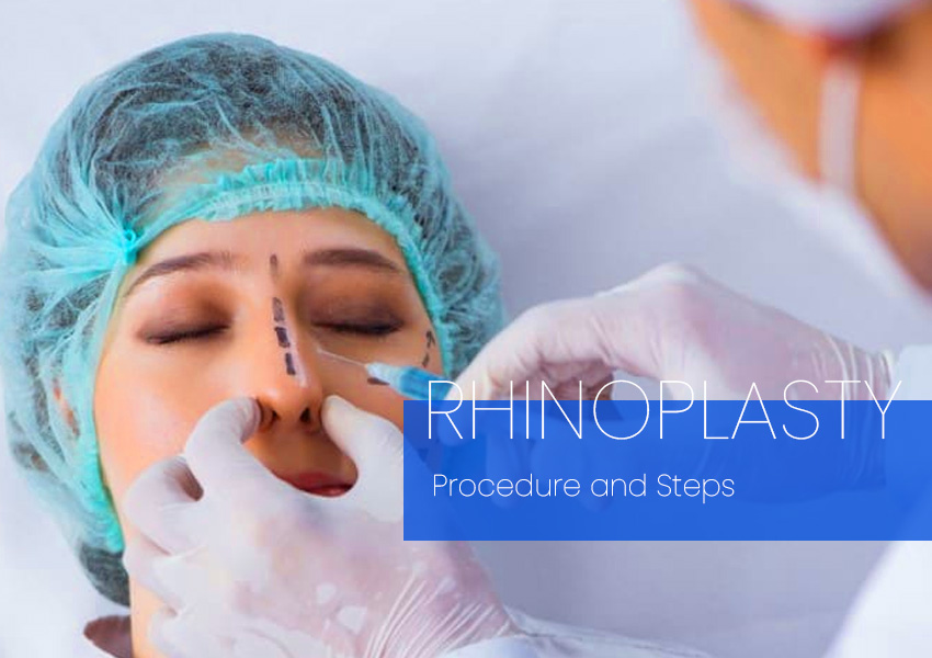 rhinoplasty surgery nose job Procedure and Steps