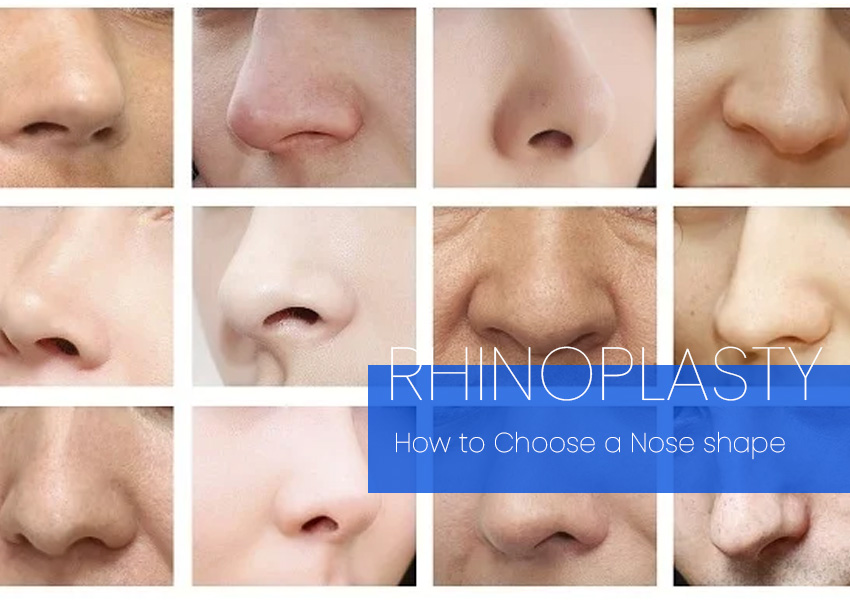 How to select type of nose shape for rhinoplasty