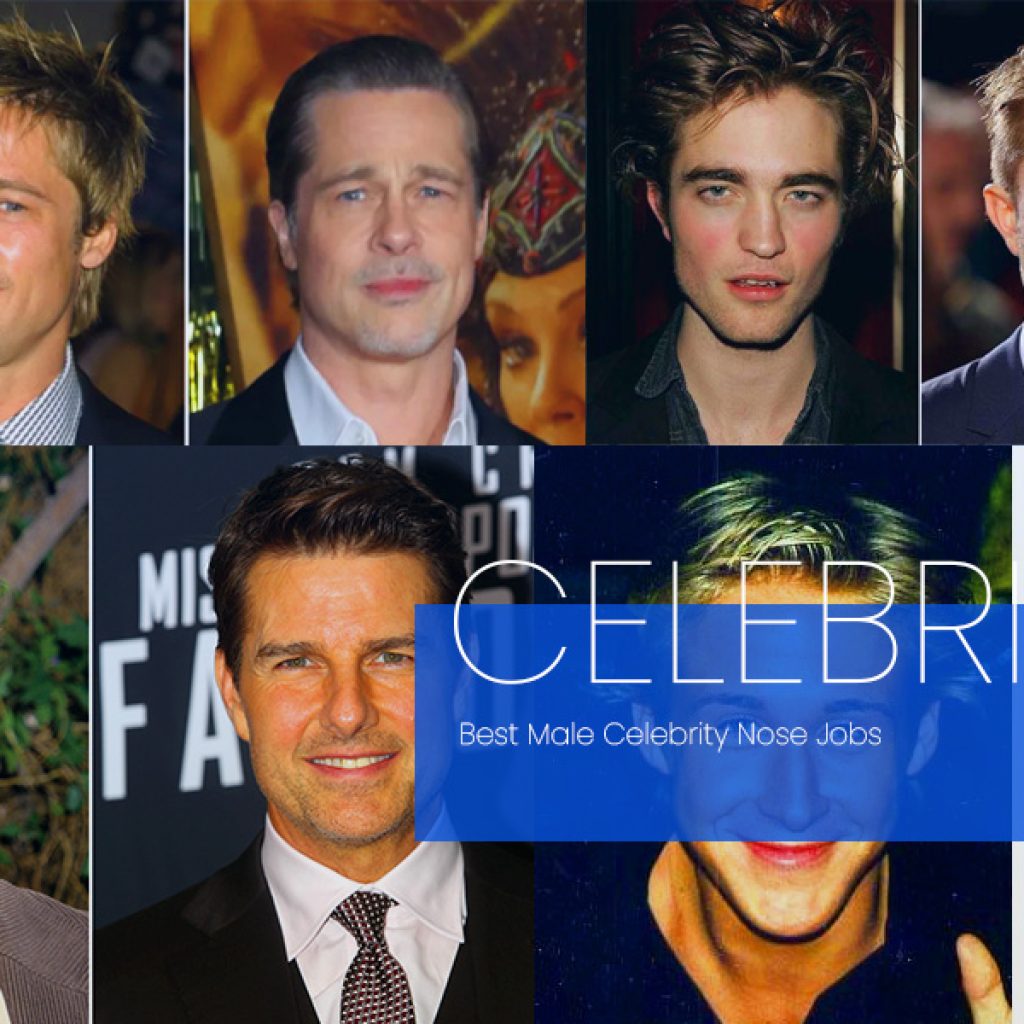 10 Male Celebrity Nose Jobs