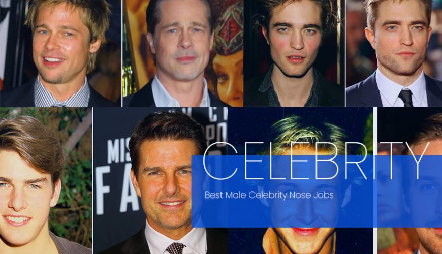 Best Male Celebrity Nose Jobs