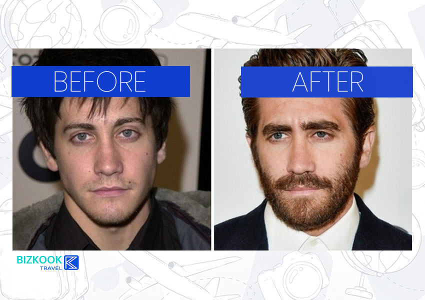 Male Celebrity Nose Jobs . Jake Gyllenhaal Before After Rhinoplasty