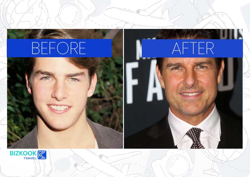 Male Celebrity Nose Jobs . Tom Cruise Before After Rhinoplasty