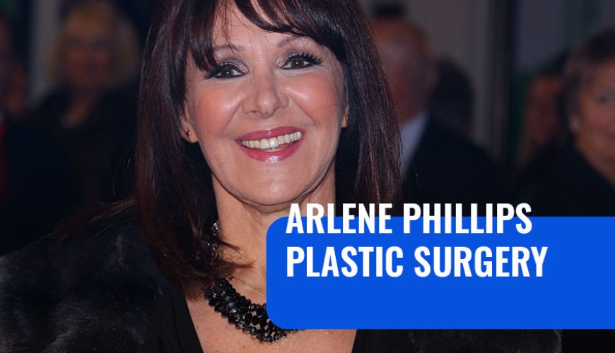 Arlene Phillips Plastic Surgery