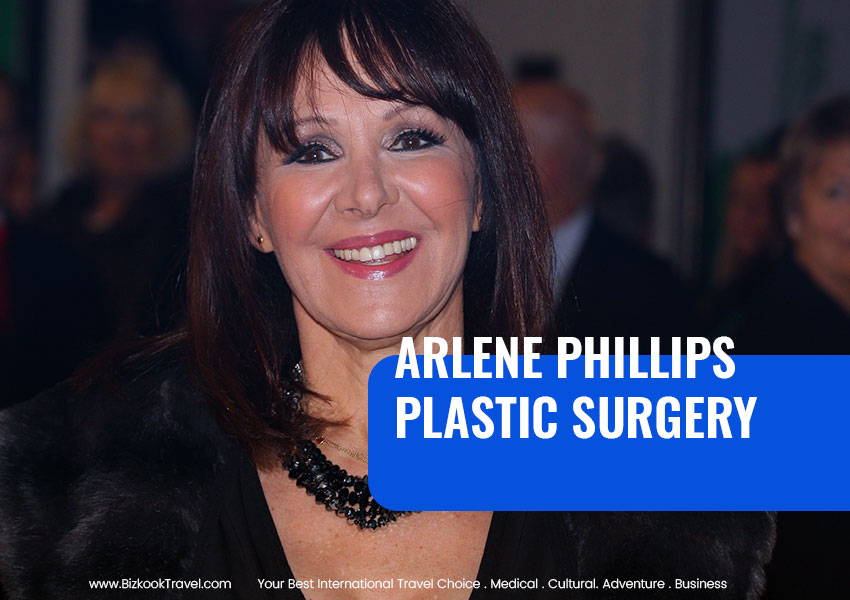 Arlene Phillips Plastic Surgery