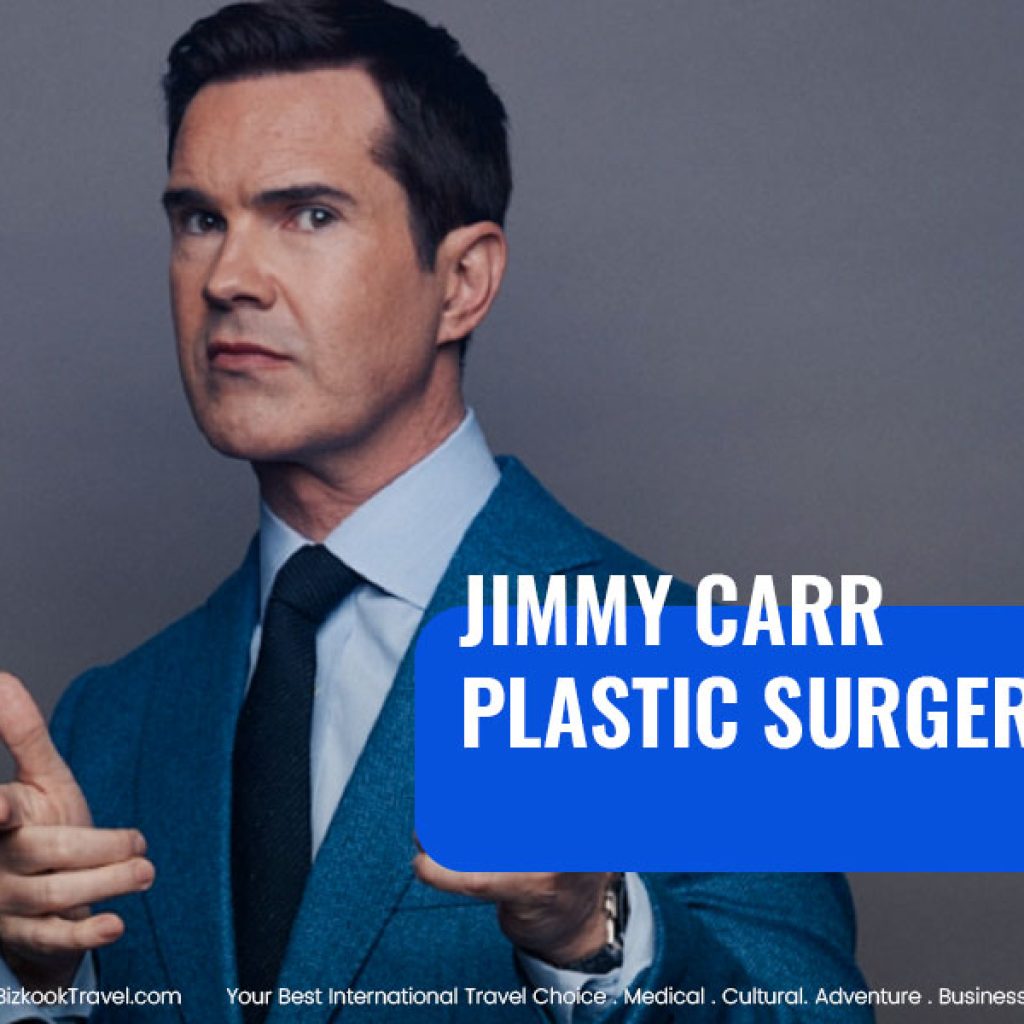 Jimmy Carr Plastic Surgery