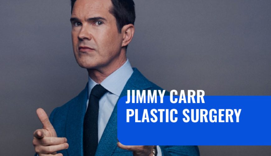 Jimmy Carr Plastic Surgery