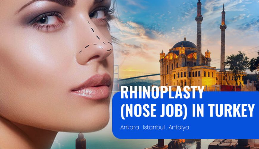 Rhinoplasty (Nose Job) in Turkey