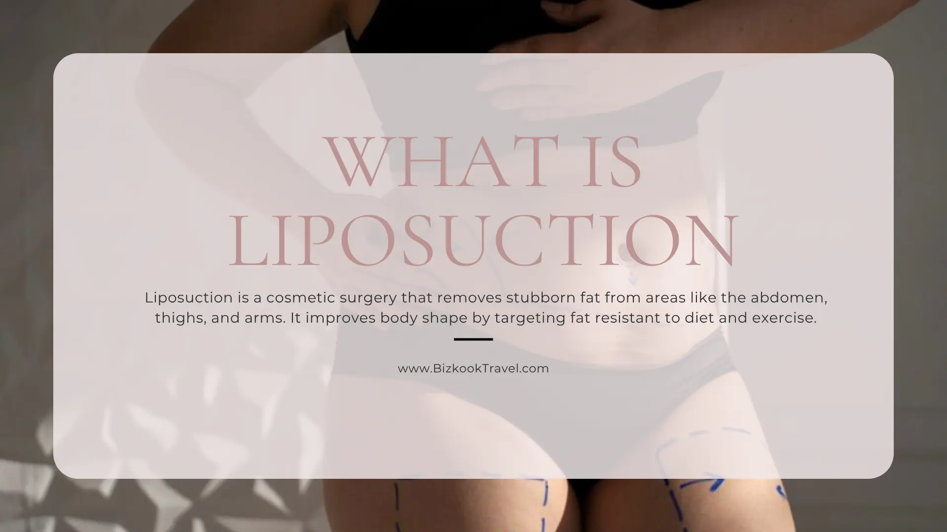 What is Liposuction