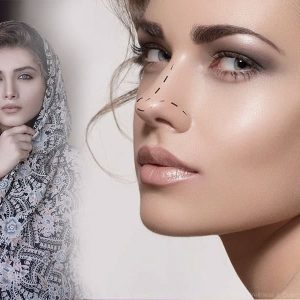 persian nose job