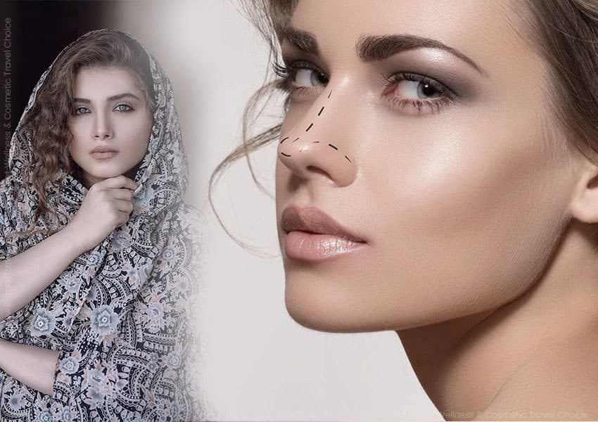 persian nose job