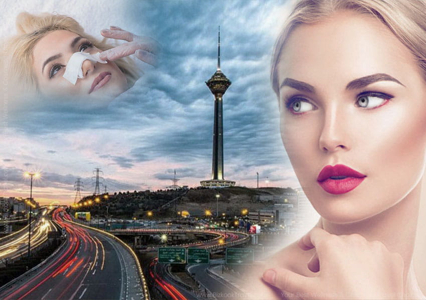 best nose surgeons in iran