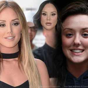 charlotte crosby plastic surgery