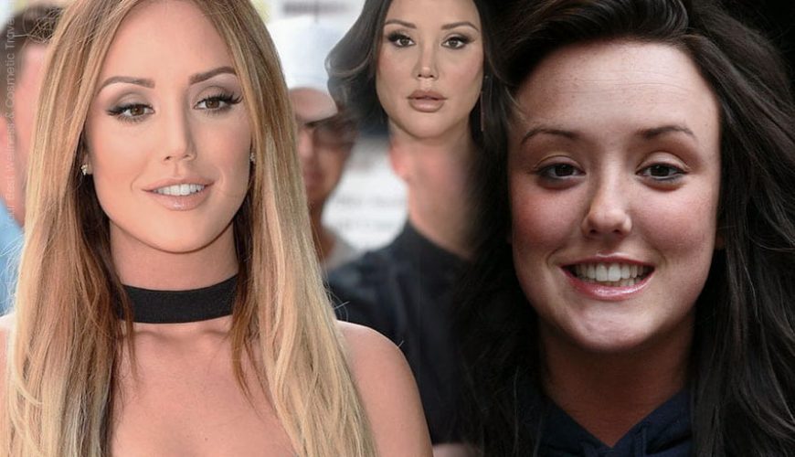 charlotte crosby plastic surgery