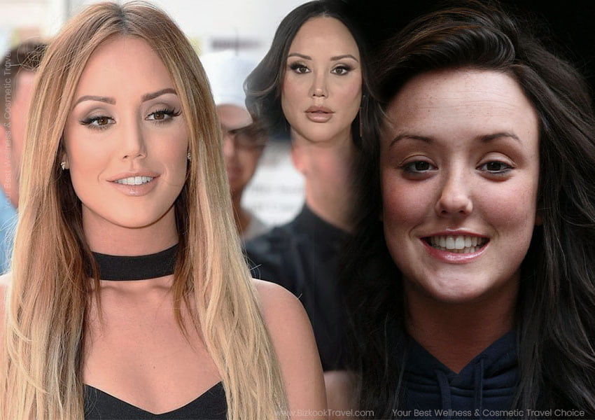 charlotte crosby plastic surgery